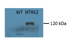 stable cell line service cases